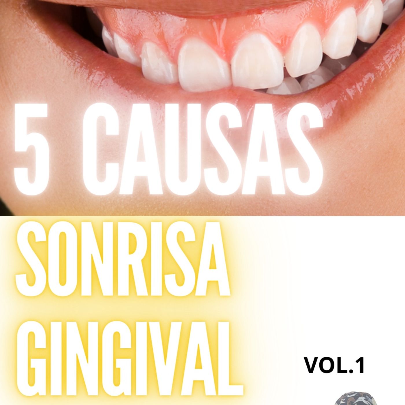 Ep. 11 - Las 5 Causas de la Sonrisa Gingival episode artwork