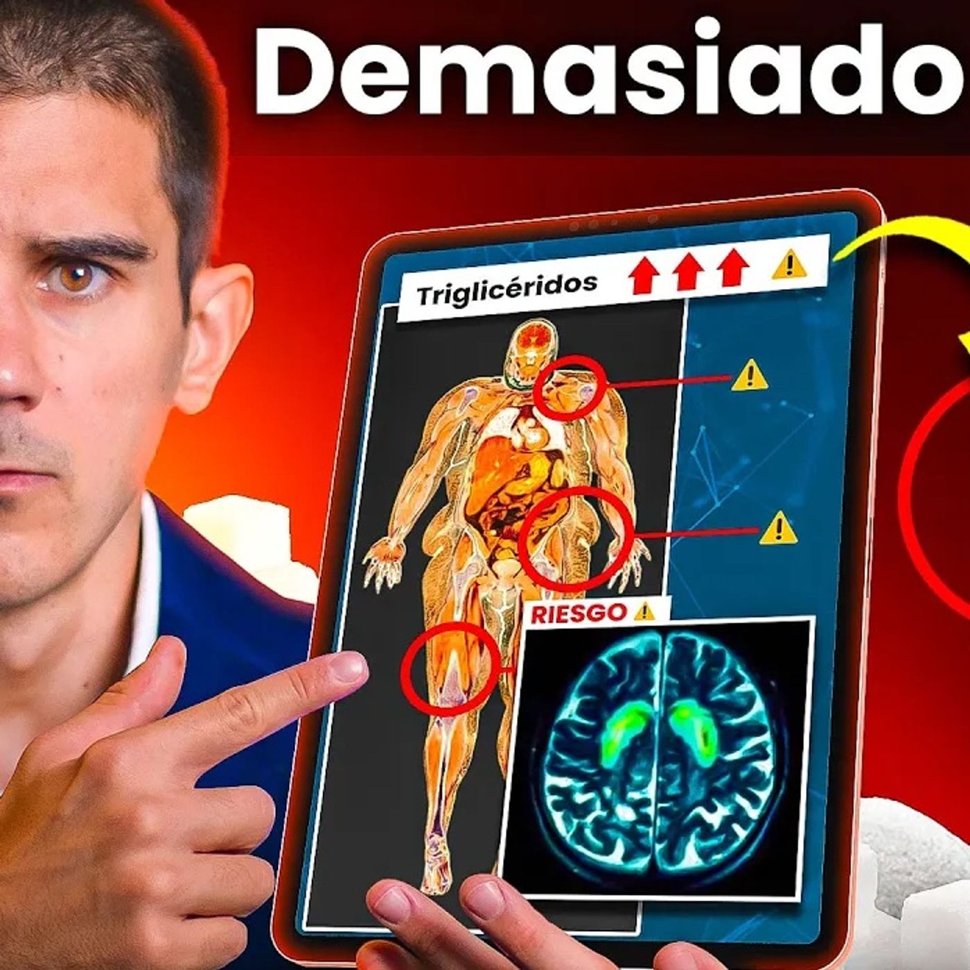 ¿Tomas DEMASIADO AZÚCAR? Esto Ocurre en TU CUERPO y METABOLISMO