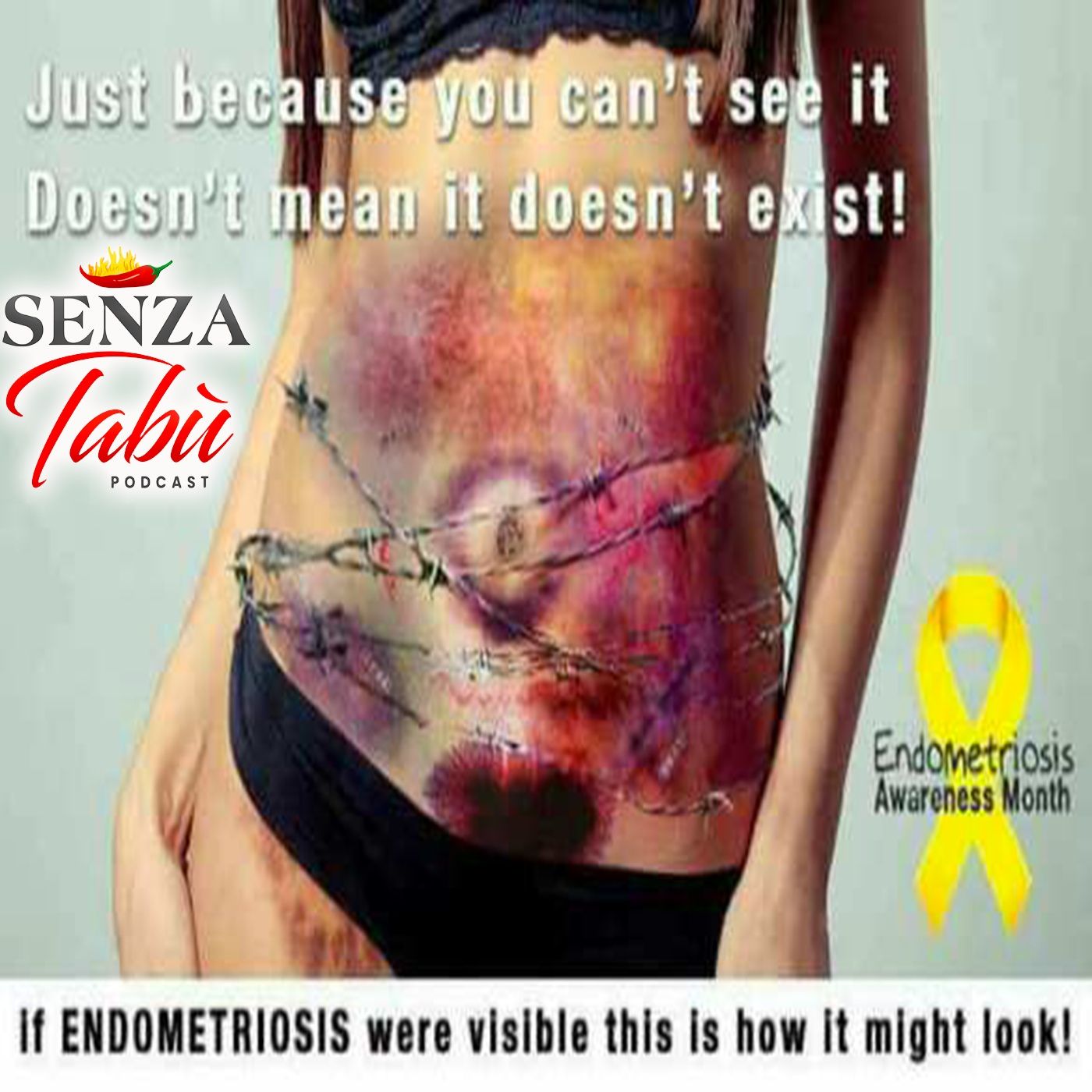 ENDOMETRIOSI ⚠️ COSA SUCCEDE DAVVERO ALLE DONNE 🌶