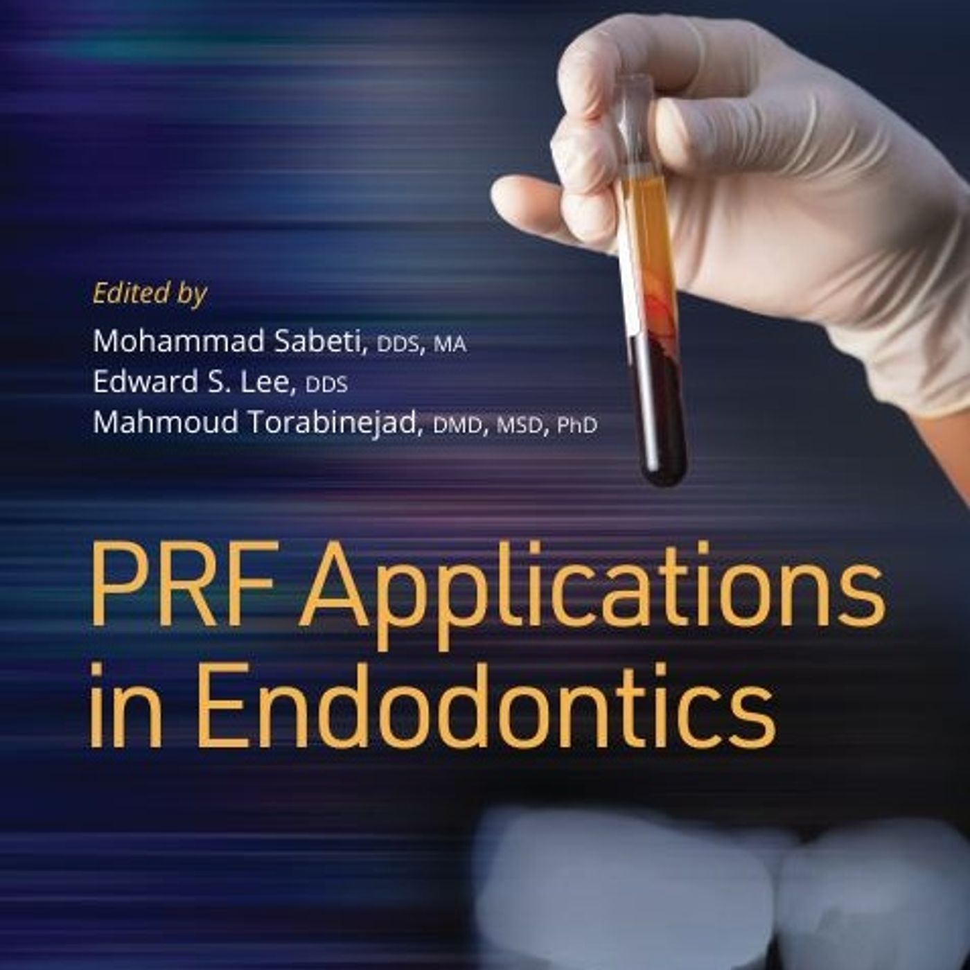 PRF Applications in Endodontics