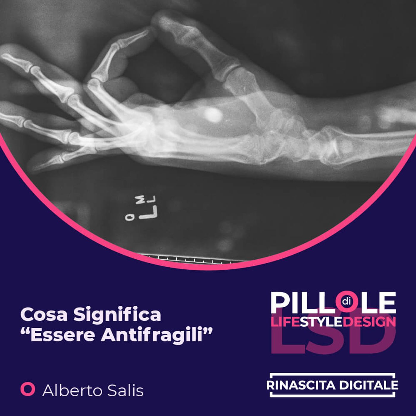 Pillole di LSD (Life Style Design)