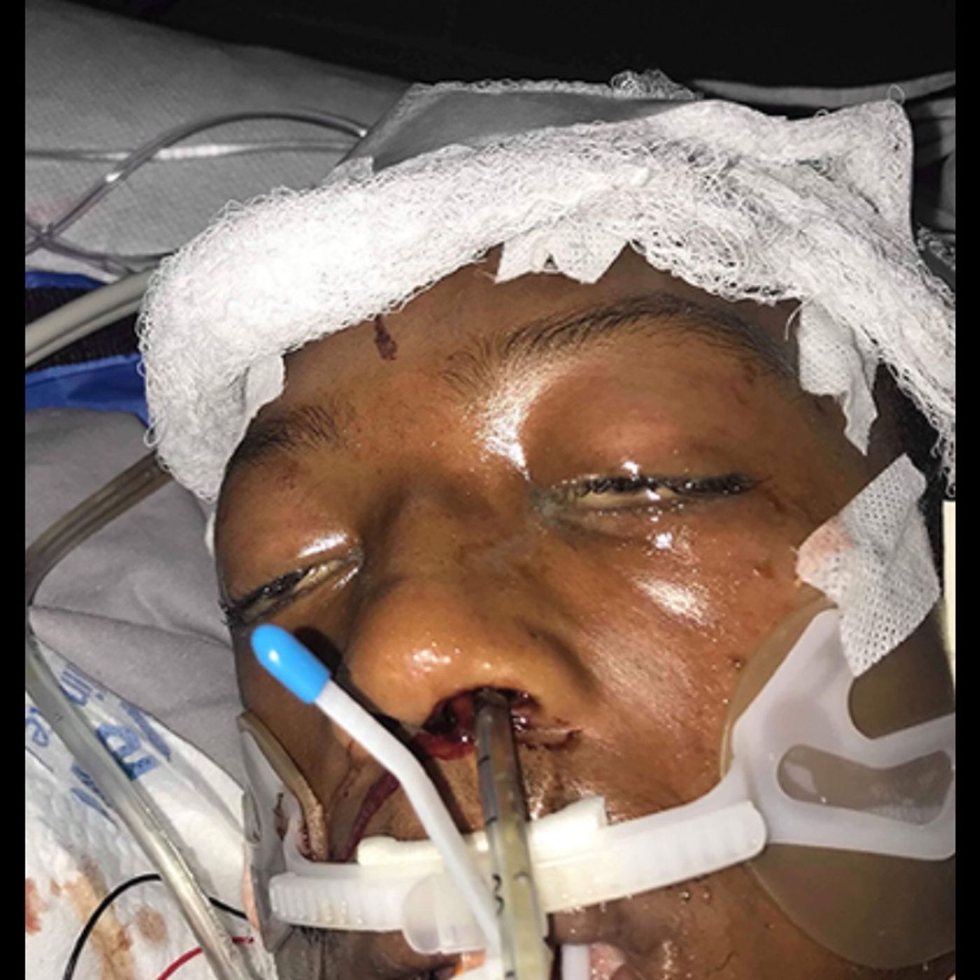 Officers indicted in death of Elijah McClain/Marcus Muhd episode artwork
