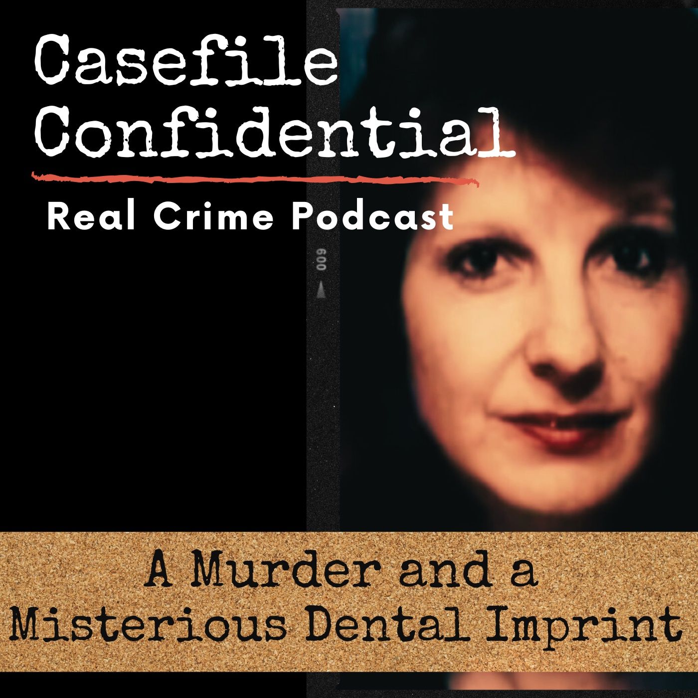 A Murdered Woman and a Dental Imprint on Her Breast