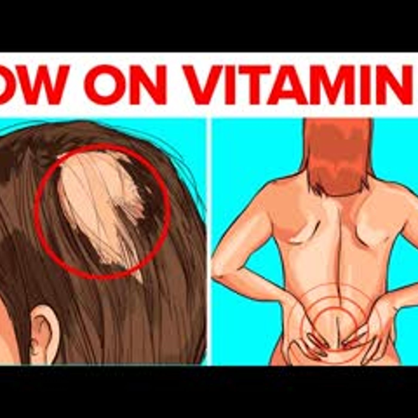 12 Illnesses Caused By Low Vitamin D episode artwork