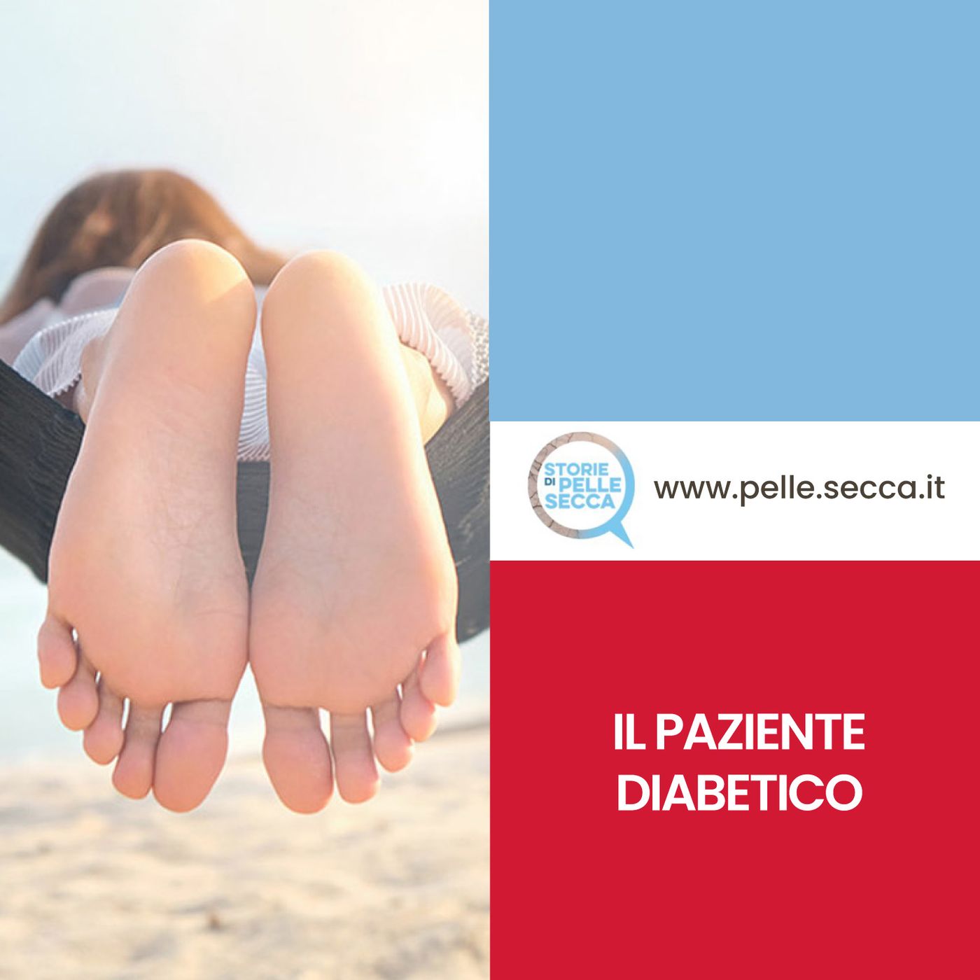 Storie di Pelle Secca