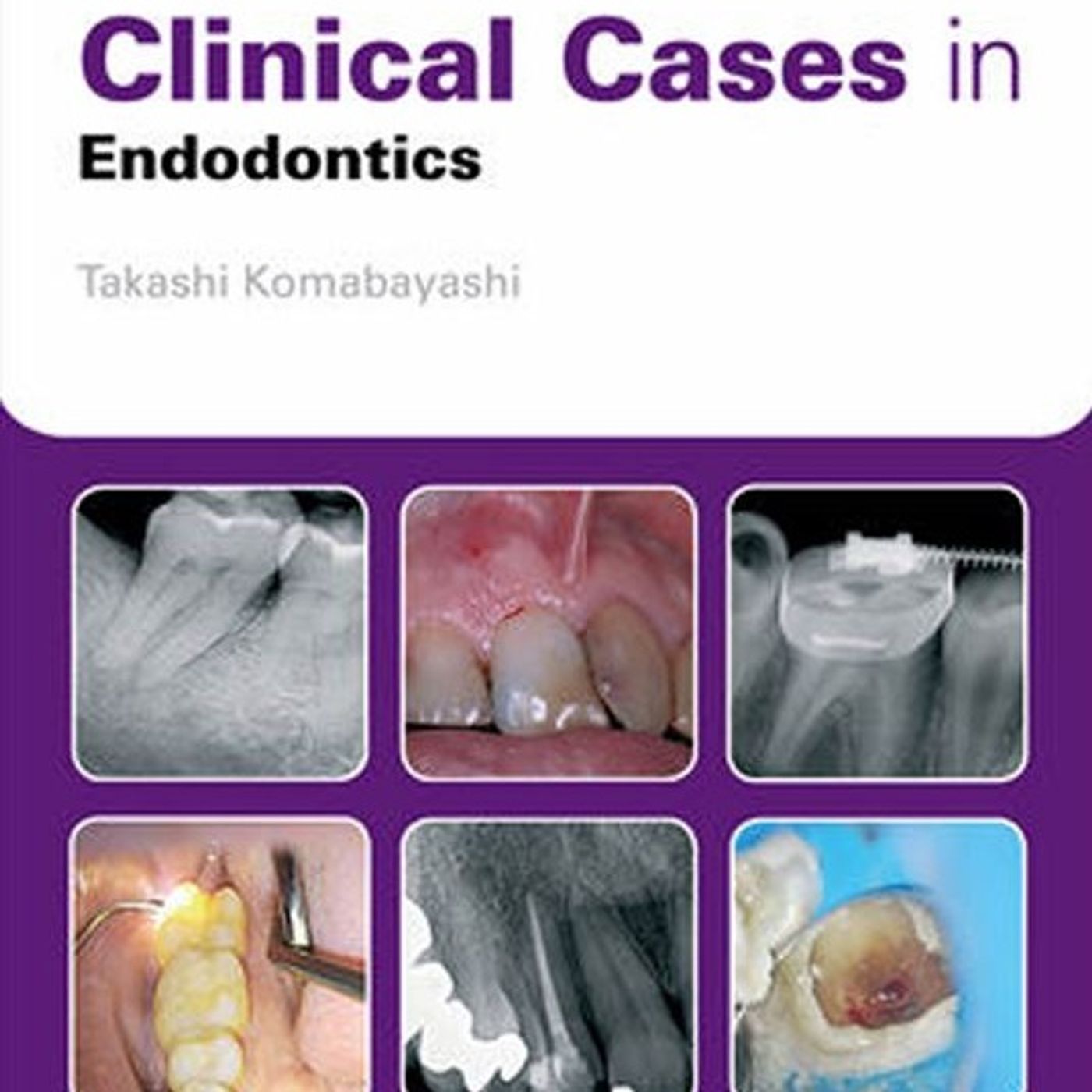 Clinical Cases in Endodontics