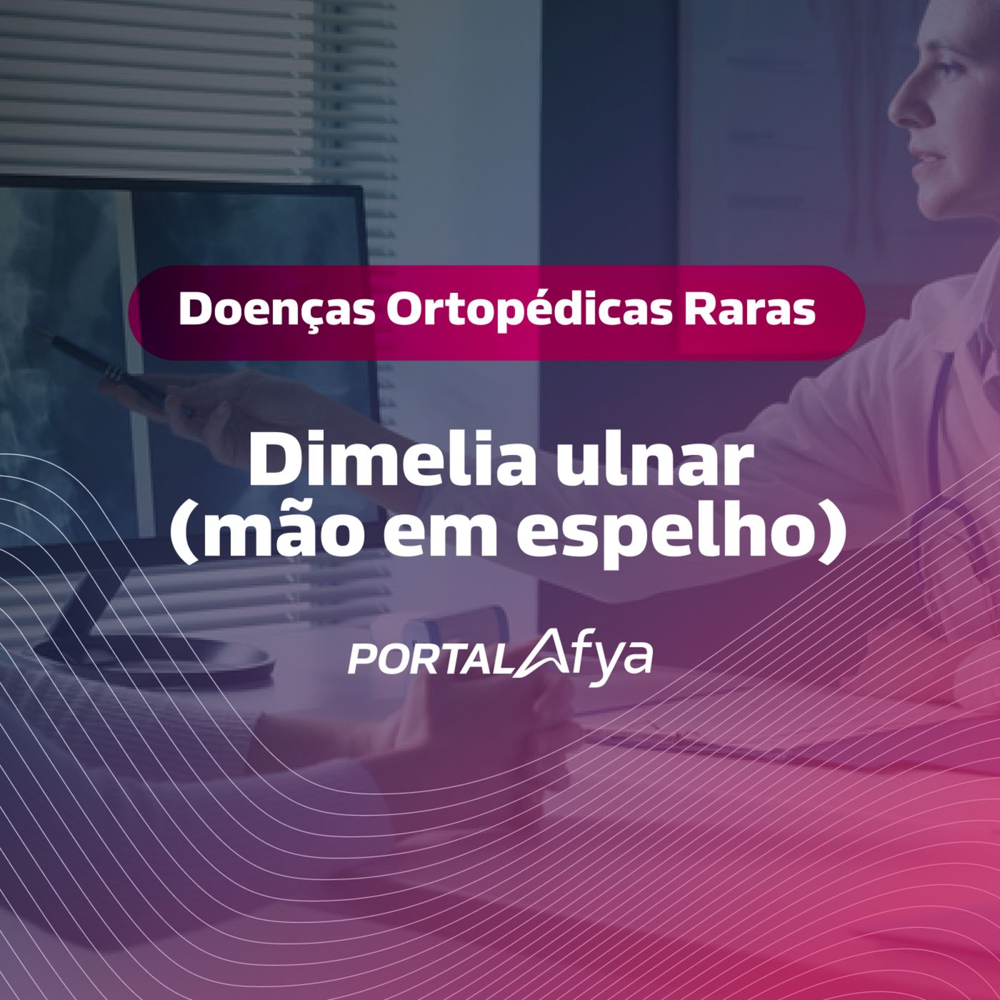 Podcast #160: Série Doenças Ortopédicas Raras: Dimelia ulnar (Mão em espelho) episode artwork
