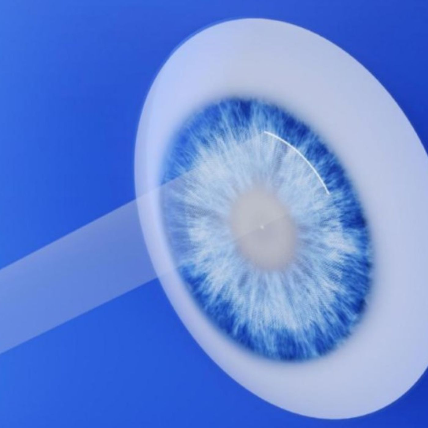 SMILE Laser Eye Surgery Talks podcast artwork