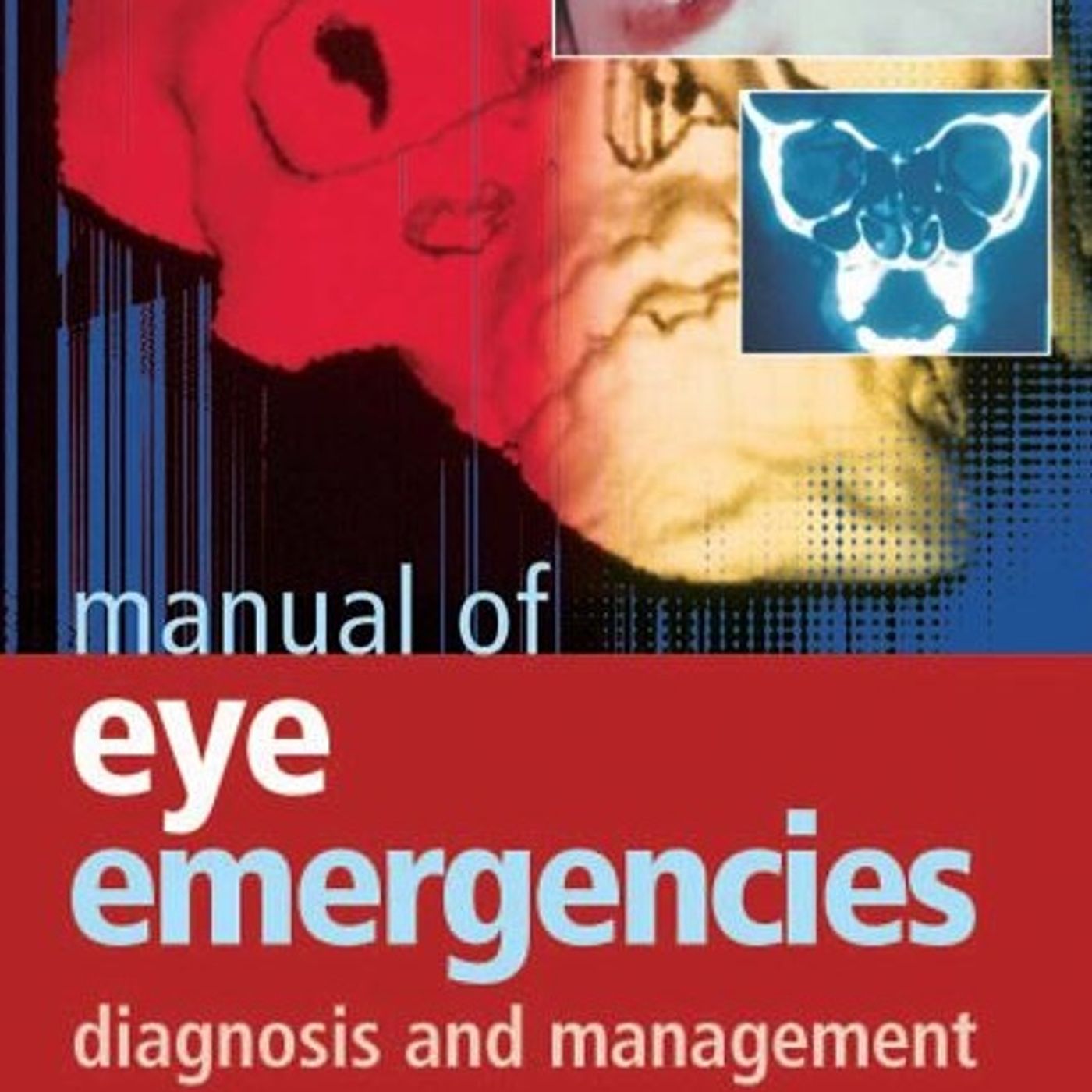 Manual of Eye Emergencies: Diagnosis and Management