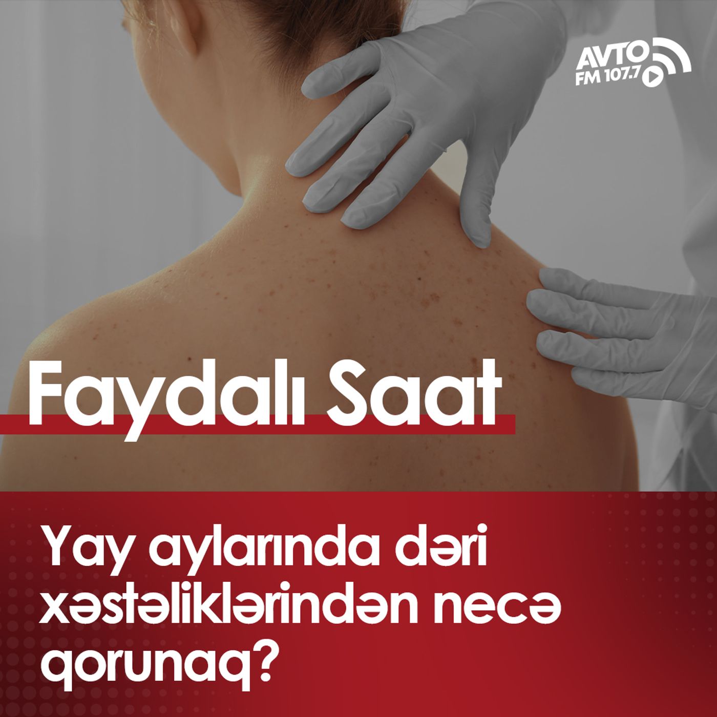 Yay aylarında dəri xəstəliklərindən necə qorunaq?