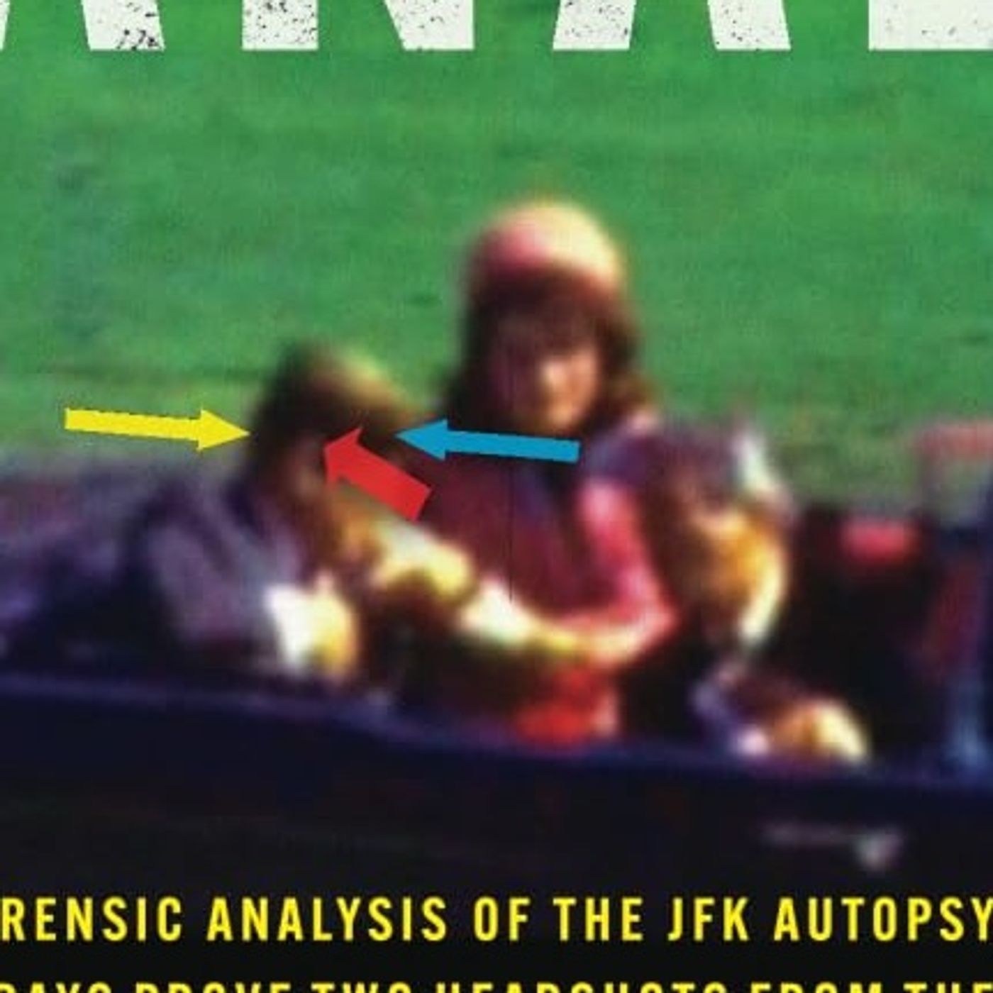 3 Bullets, Multiple Shooters: The Real JFK Story