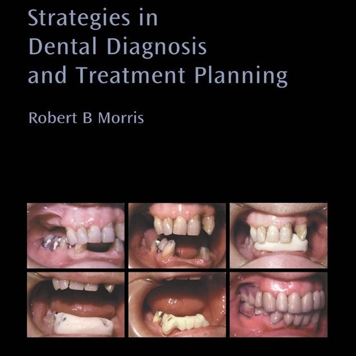 STRATEGIES IN DENTAL DIAGNOSIS AND TREATMENT PLANNING