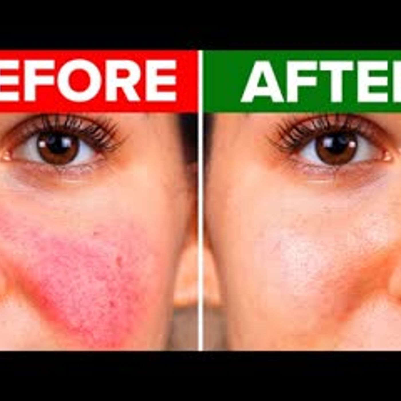11 Ways For You To Get Dewy Looking Skin episode artwork