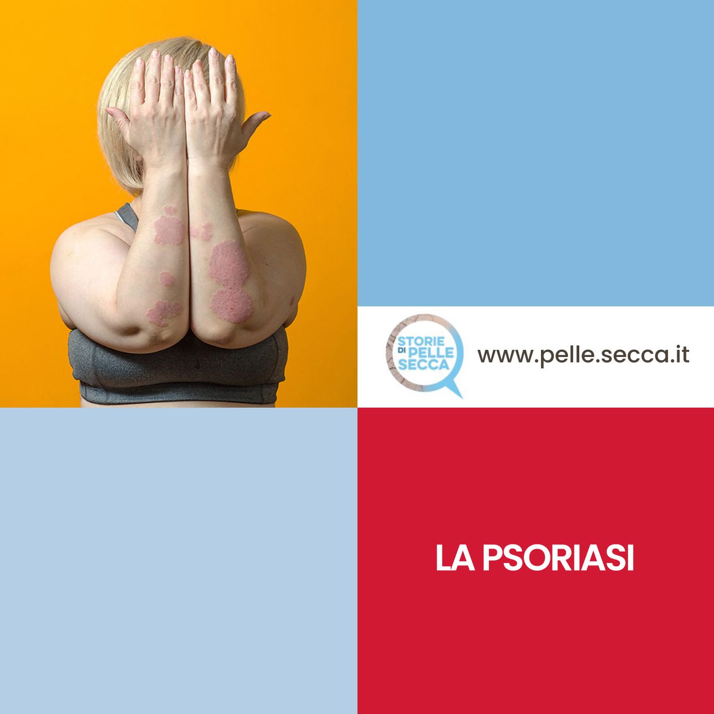 Storie di Pelle Secca