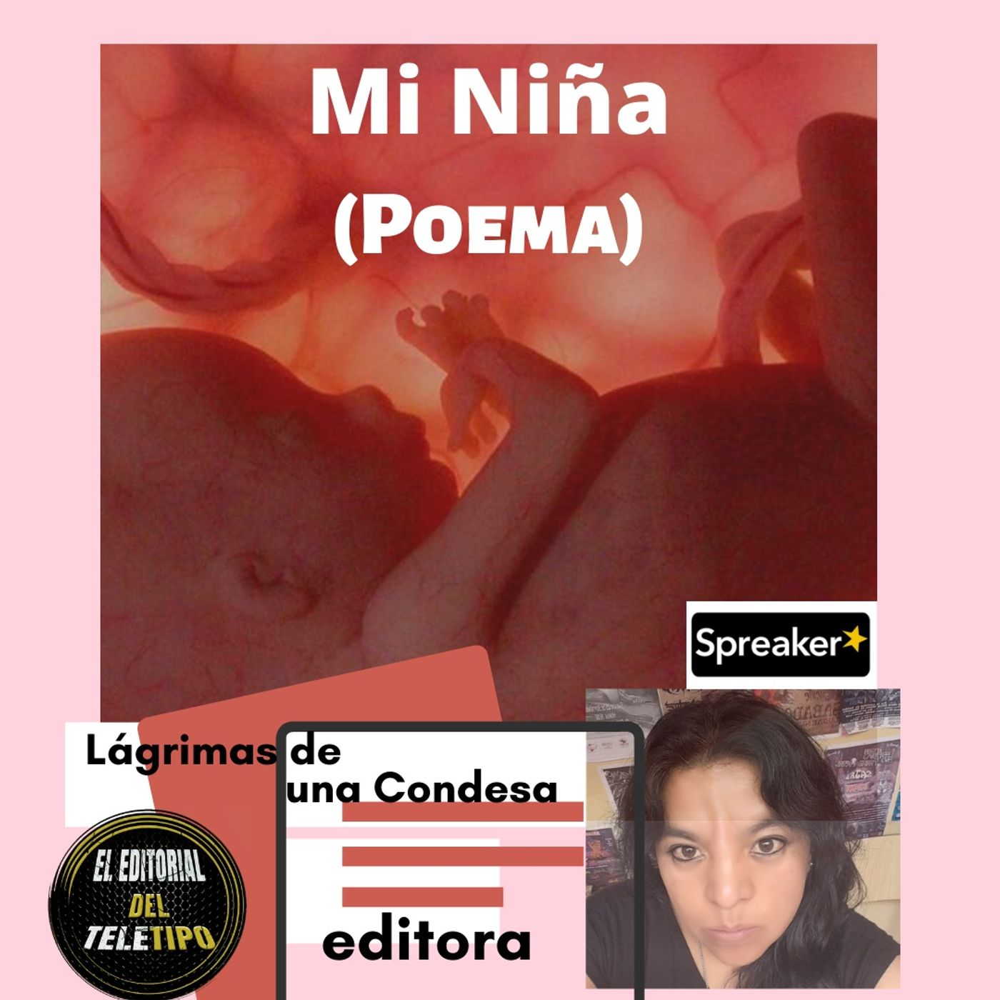 PROGRAMA 4