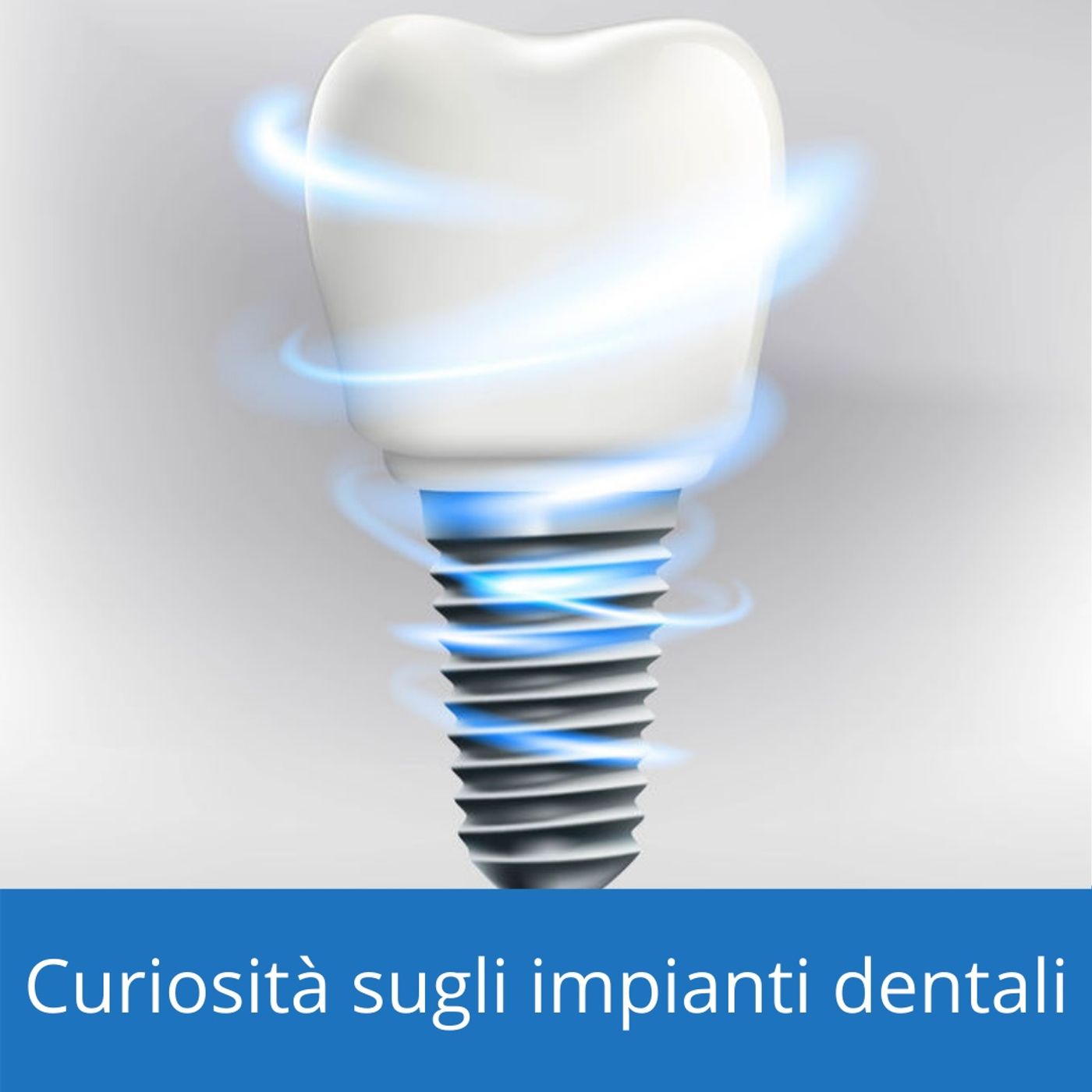 Impianti dentali curiosità