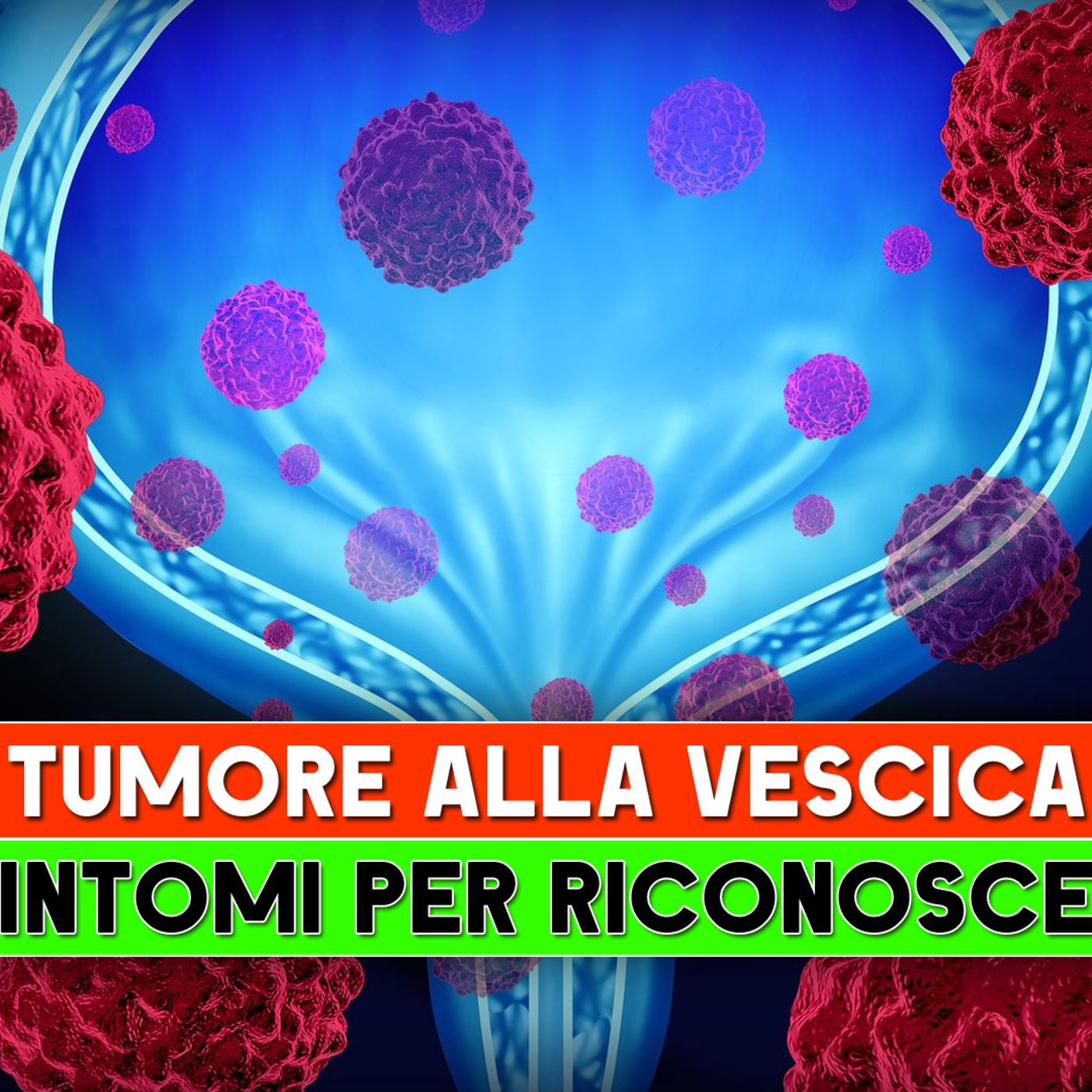 Tumore Alla Vescica: I 5 Sintomi Per Riconoscerlo! episode artwork