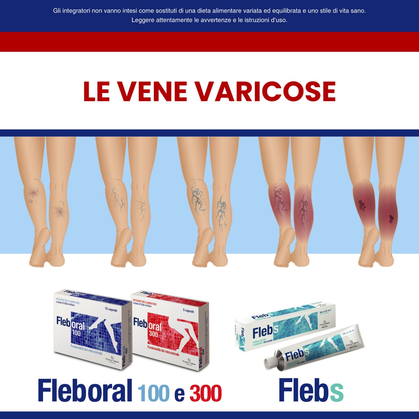 Le vene varicose episode artwork