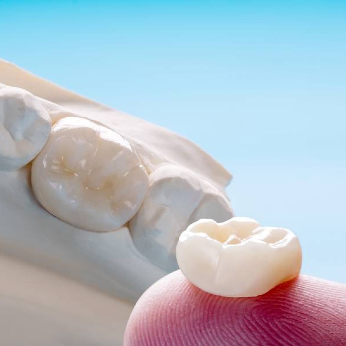 Dental Crowns Helpful or Harmful Breaking Down the Facts episode artwork