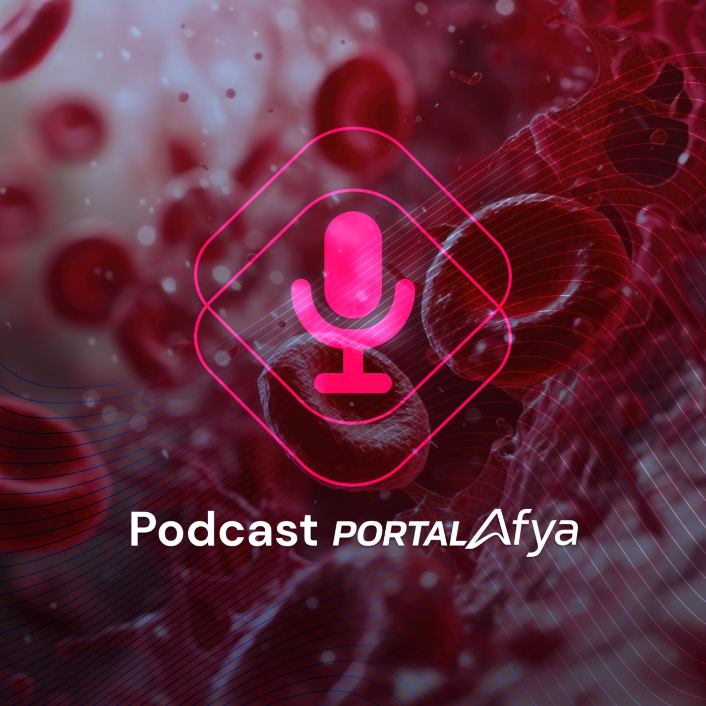 Podcast #143: Anticoagulação no paciente com AVC isquêmico e fibrilação atrial episode artwork