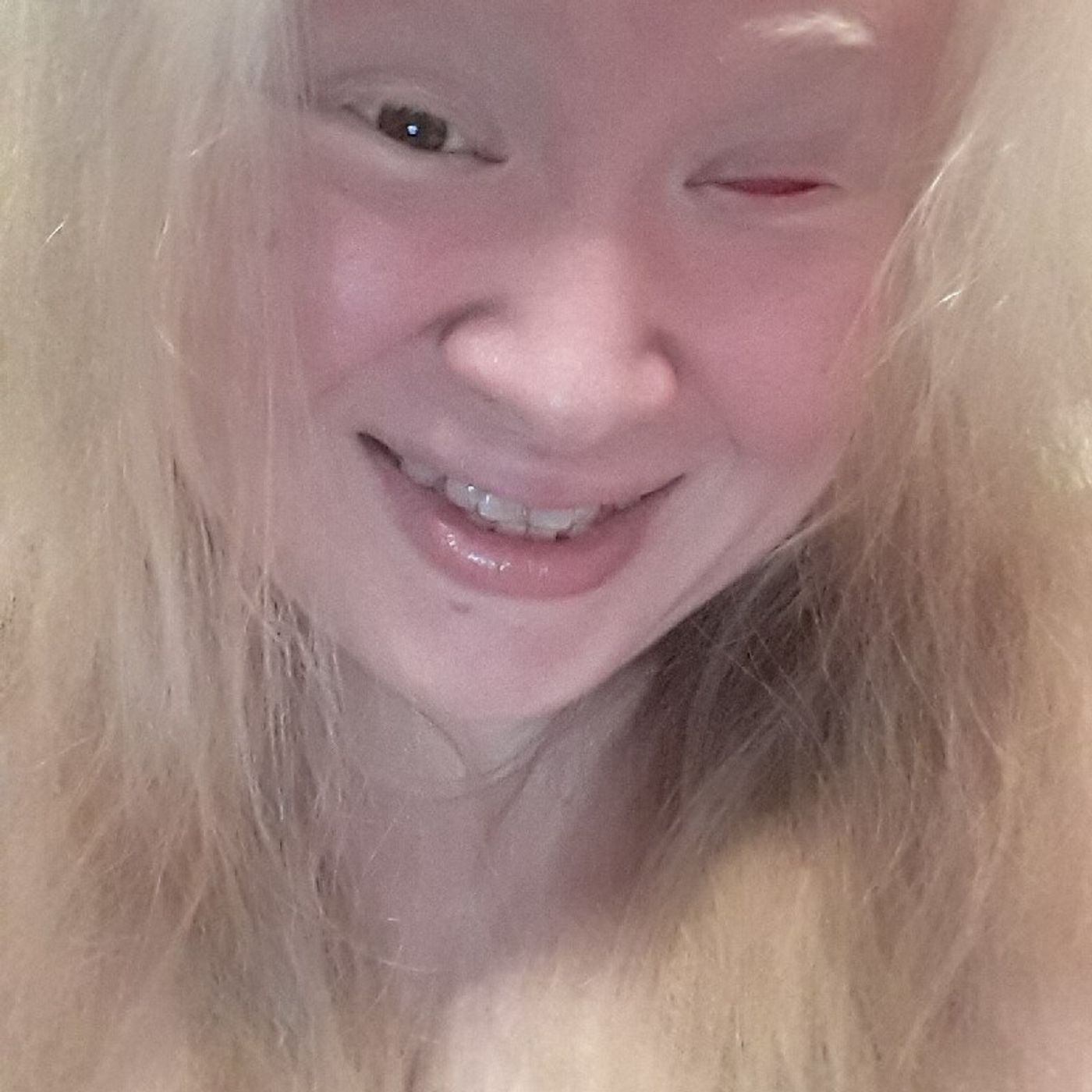 Episode 12 - Albino Moon Child SO MUCH LOVE IT MAKES MY SOUL SHAKE!!! I ❤ U ALL!!!