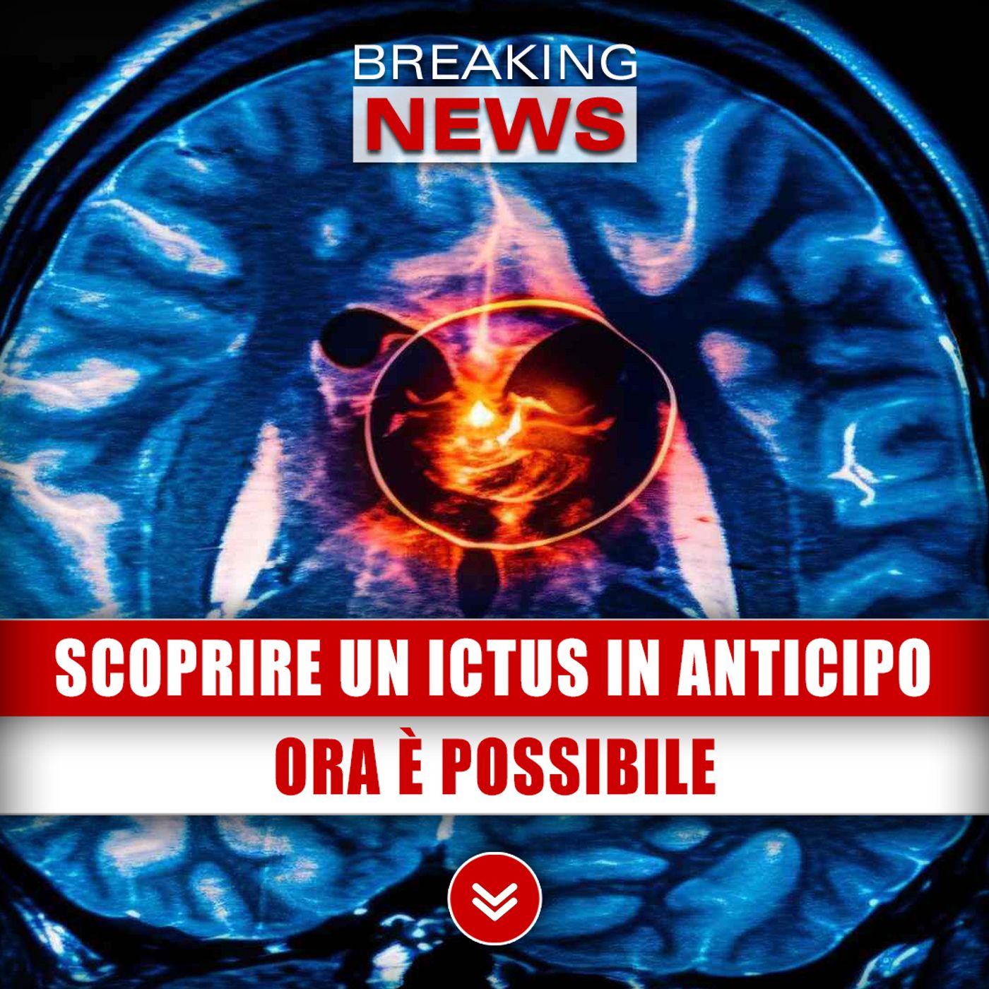 Scoprire Un Ictus In Anticipo: Ora È Possibile Grazie Agli Esperti!