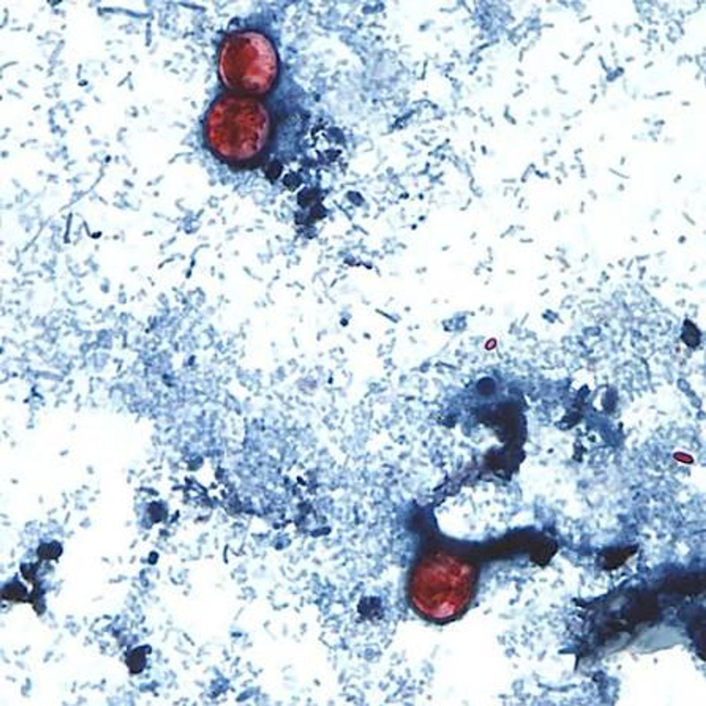 Test results create more confusion around cyclosporiasis outbreak episode artwork
