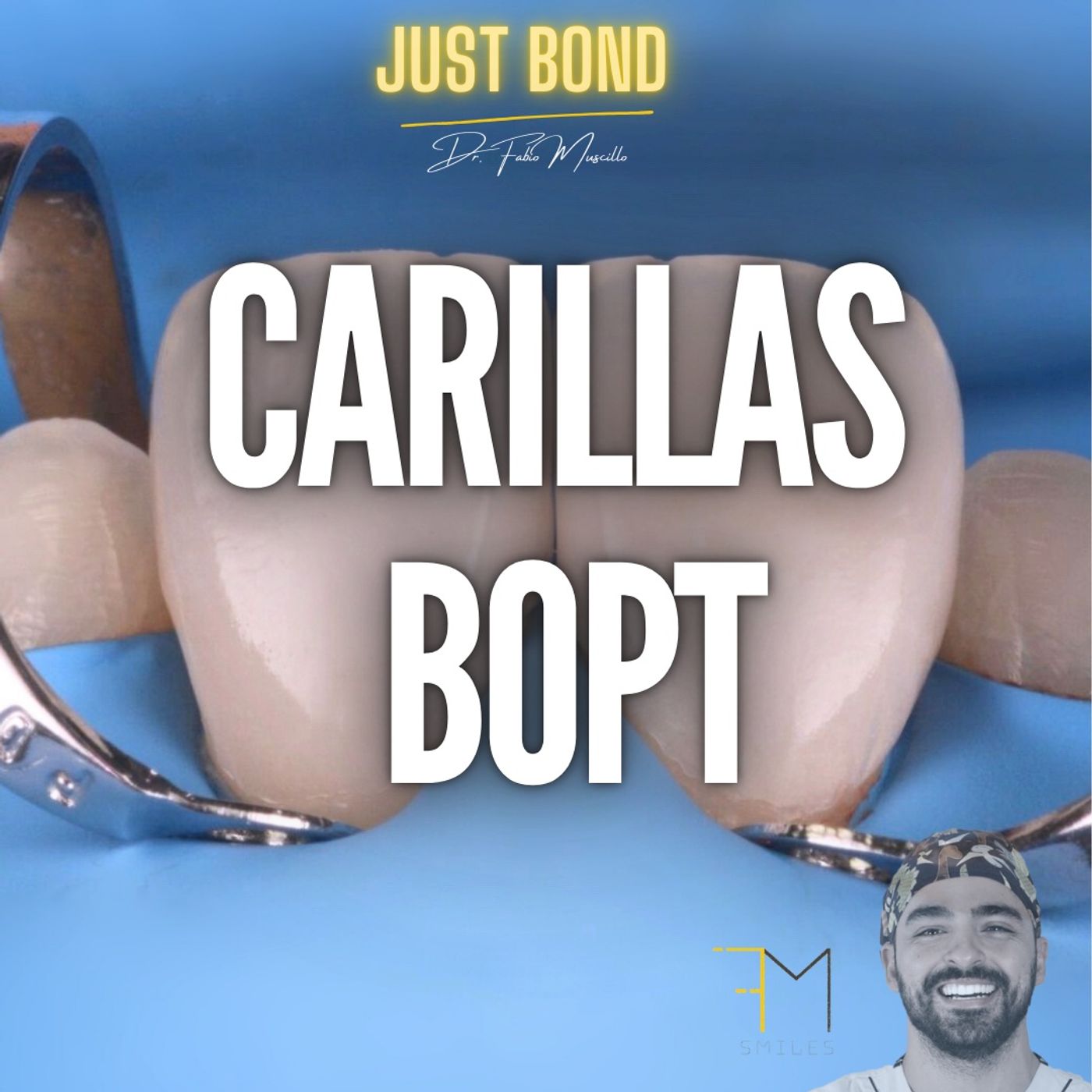 Ep. 21 Carillas BOPT ¿cuando, como y porque? episode artwork