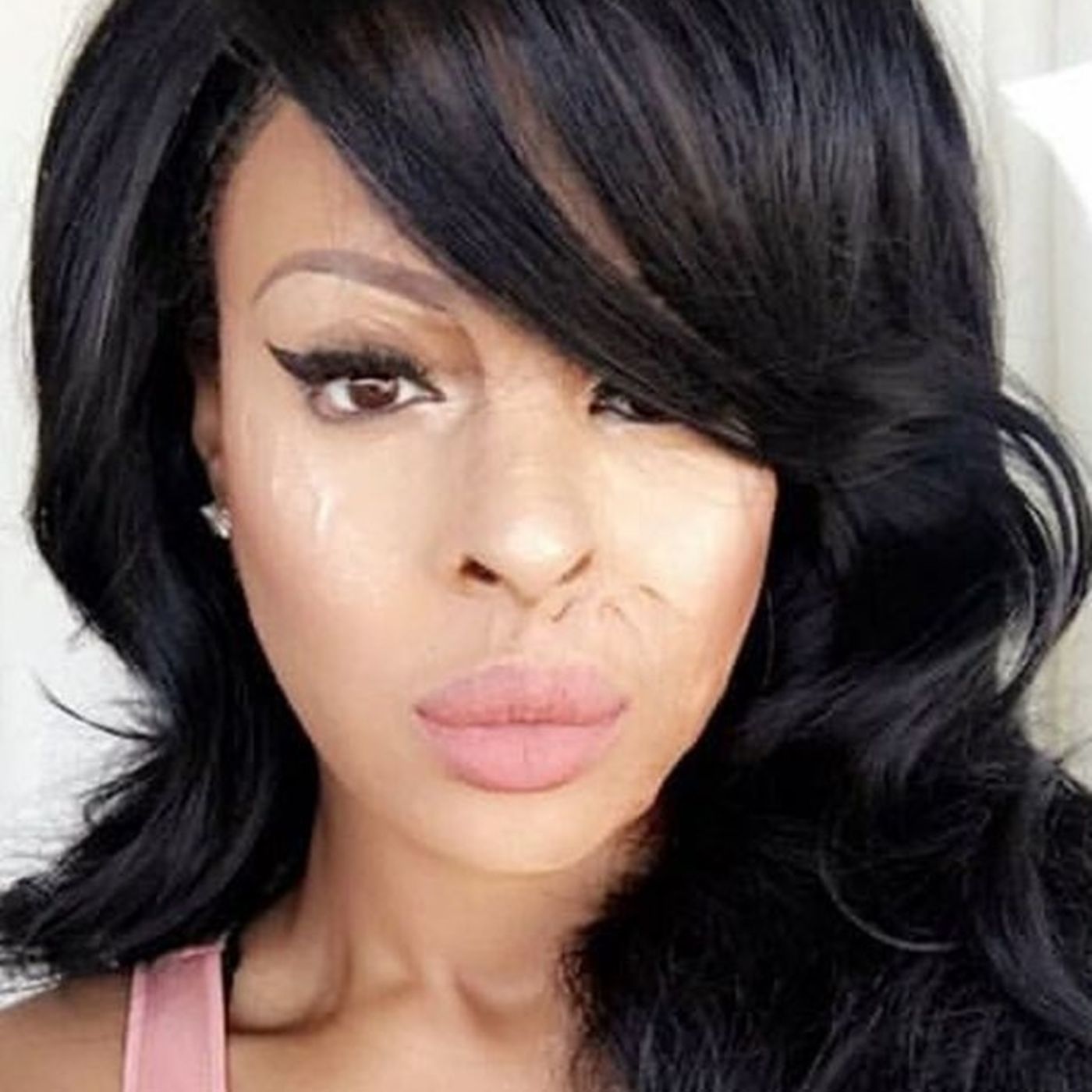 133. Acid Attack : The Betrayal of Naomi Oni