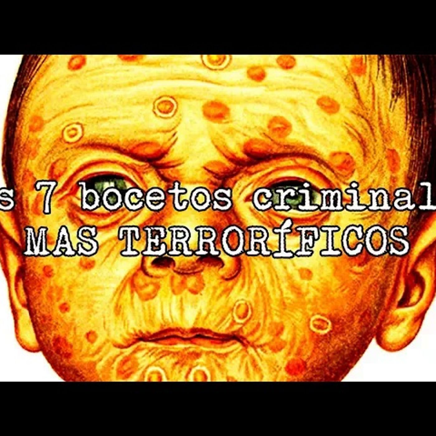 Portada de El Podcast de DrossRotzank
