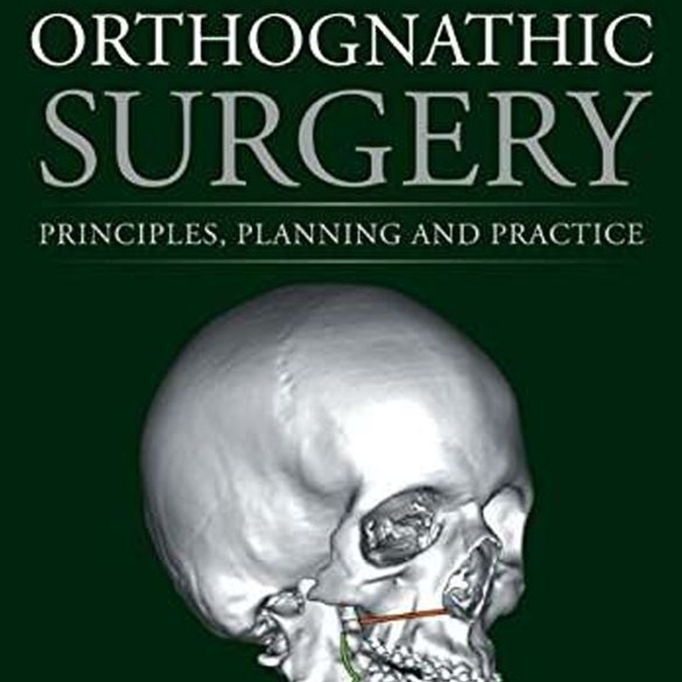 Orthognathic Surgery:  Principles, Planning and Practice