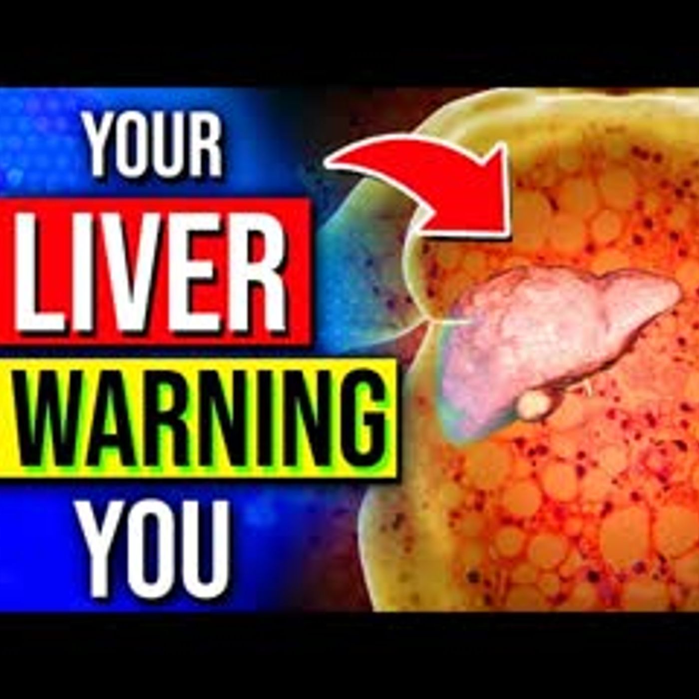 14 Unhealthy Signs Your Liver Is Warning You About episode artwork