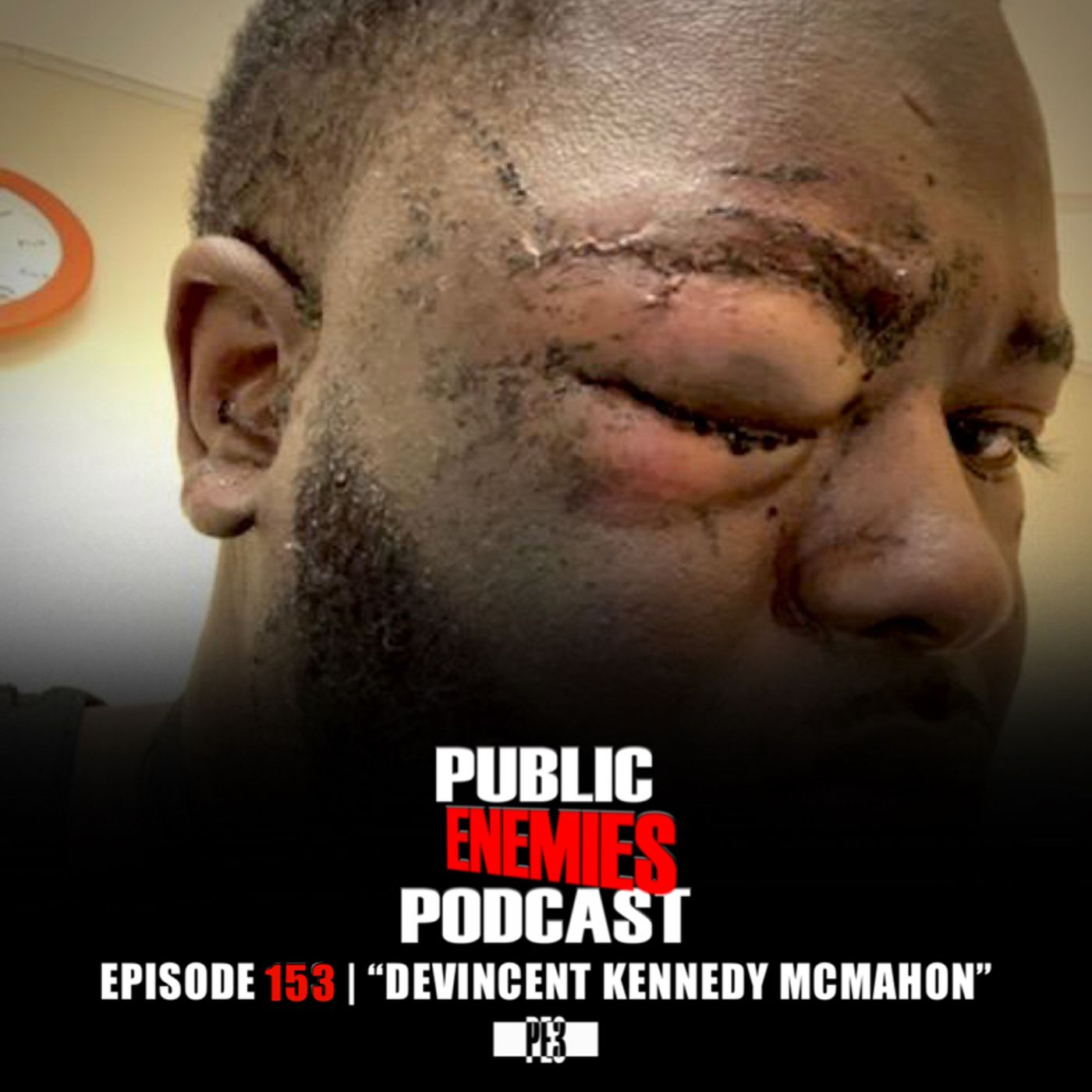 Ep. 153 | "DeVincent Kennedy McMahon" w/ DeadAssGirls, WrestleMania fallout, NXT & AEW + more