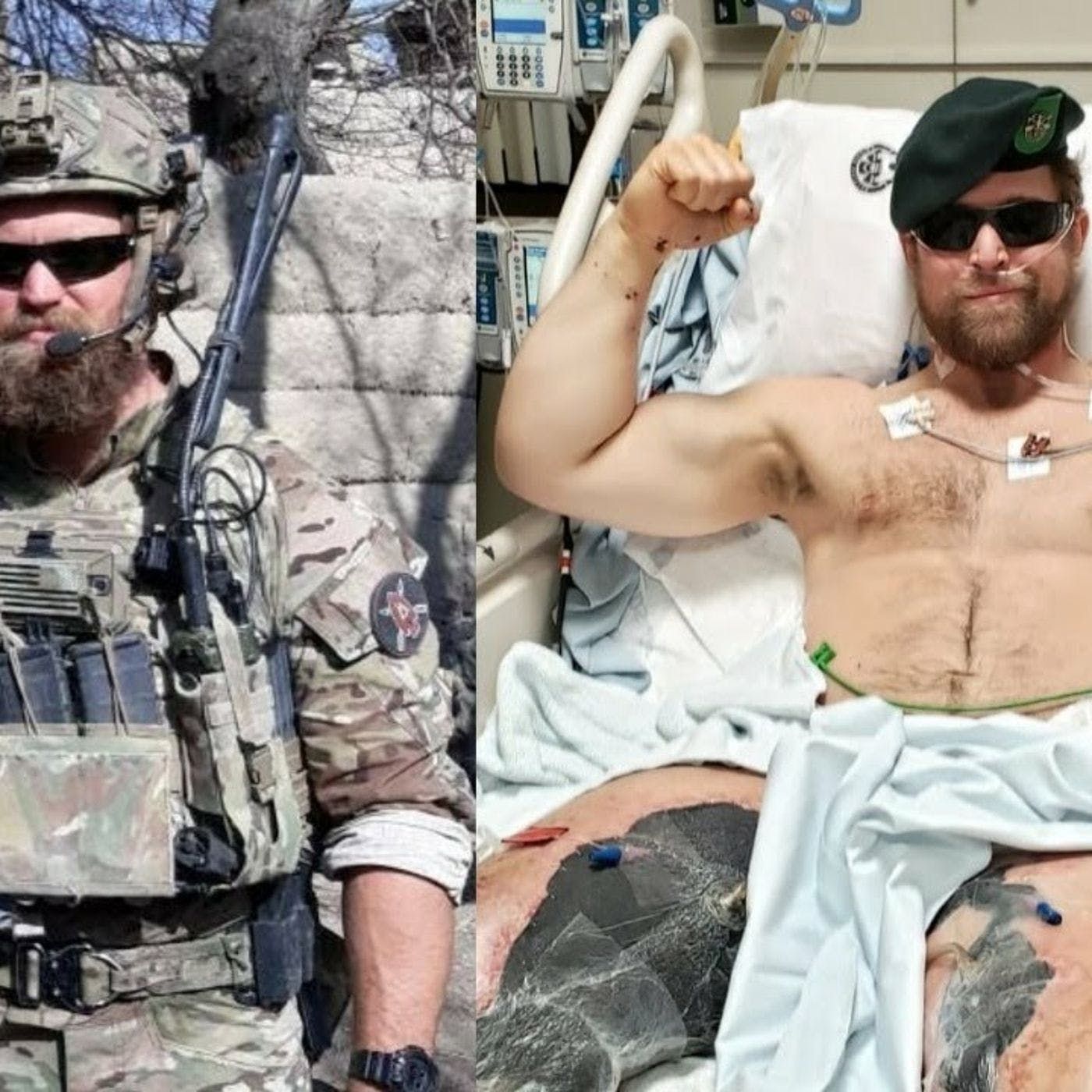 Green Beret and double amputee Justin Lascek, Ep. 69