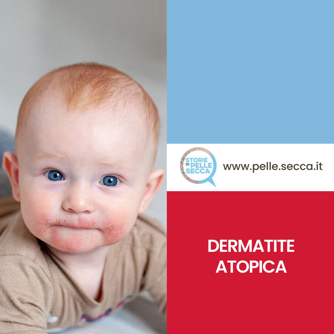 Storie di Pelle Secca