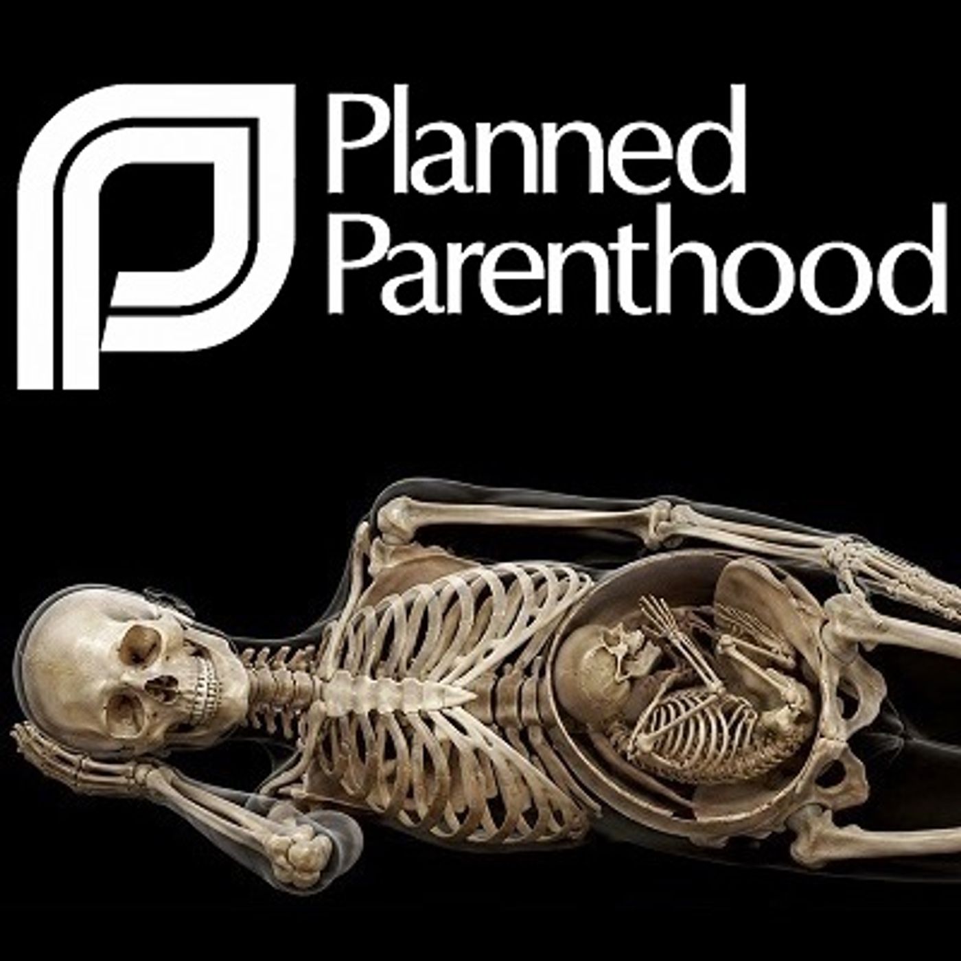Planned Parenthood nasconde la morte di una donna durante un aborto episode artwork