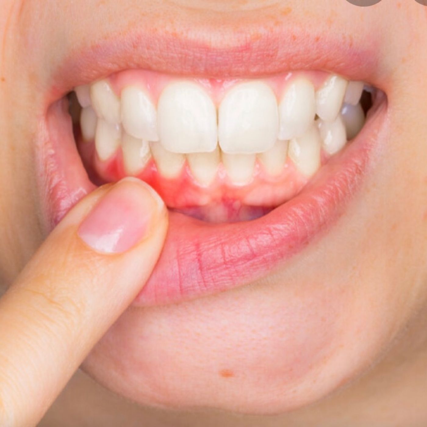 Is gum disease linked to Heart Disease?