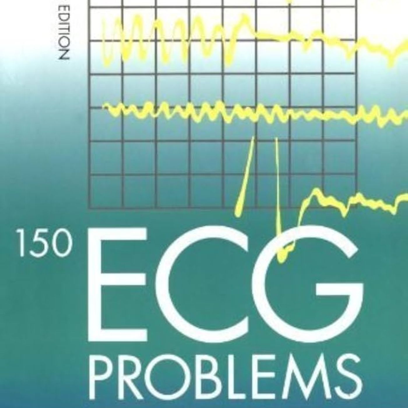 150 ECG Problems