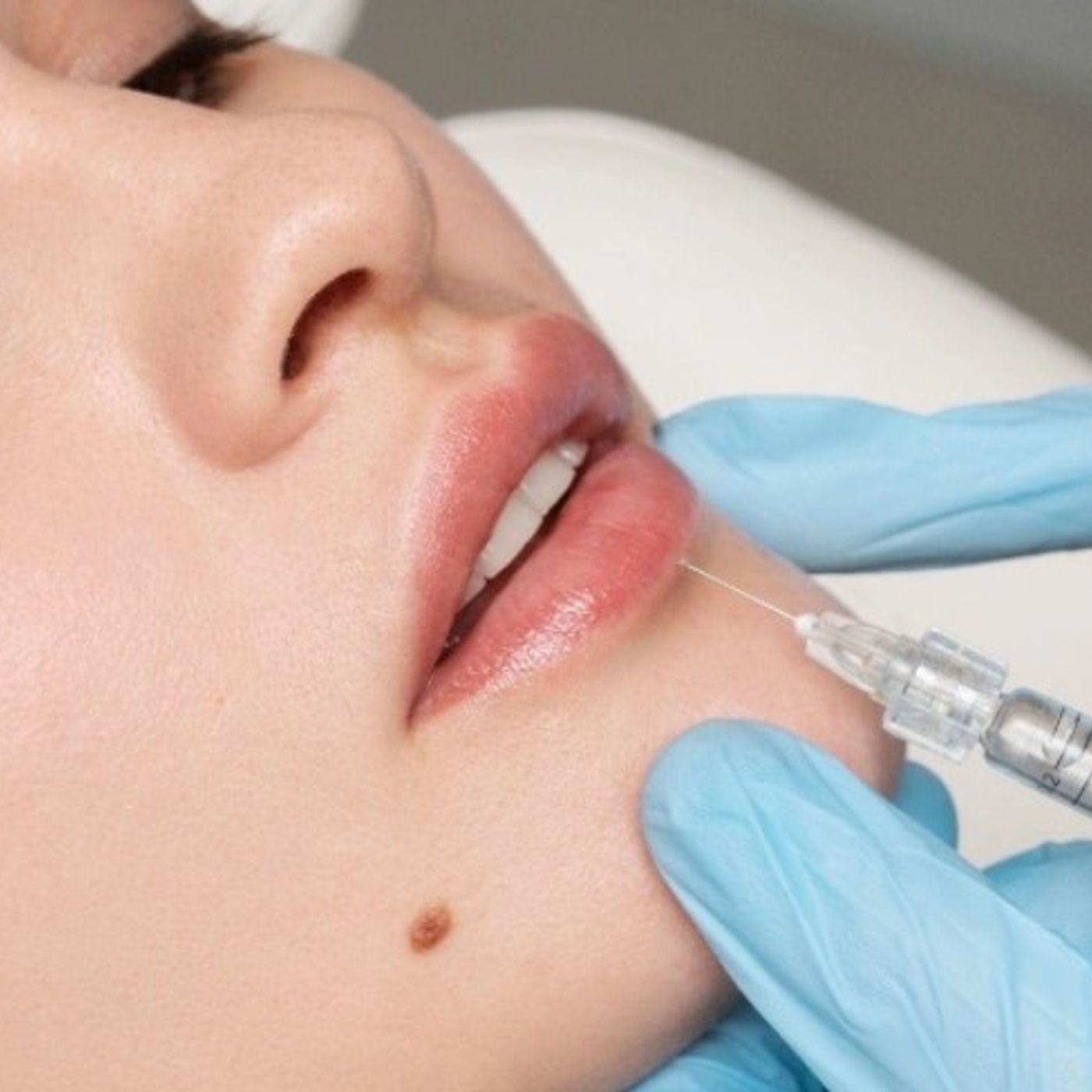 Lip Filler in Center Moriches