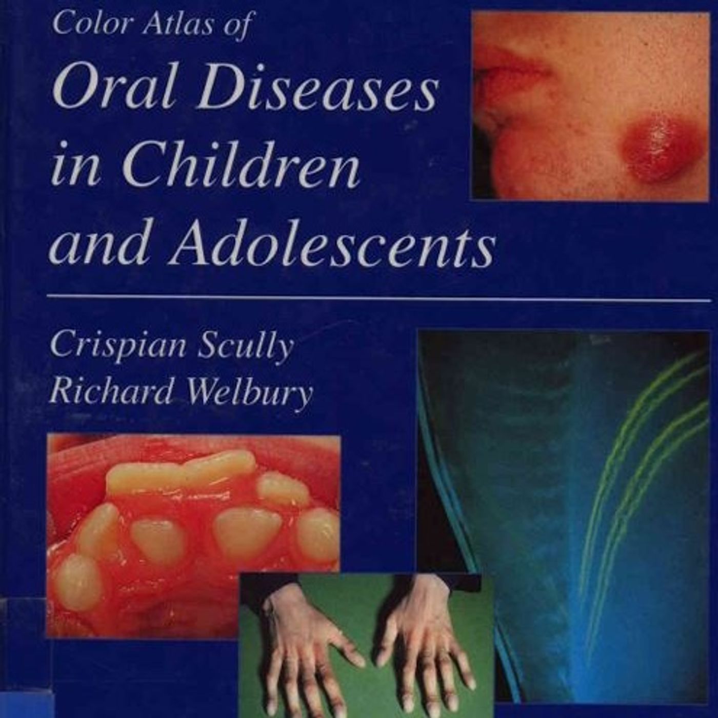 Colour Atlas of Oral Diseases in Children and Adolescence