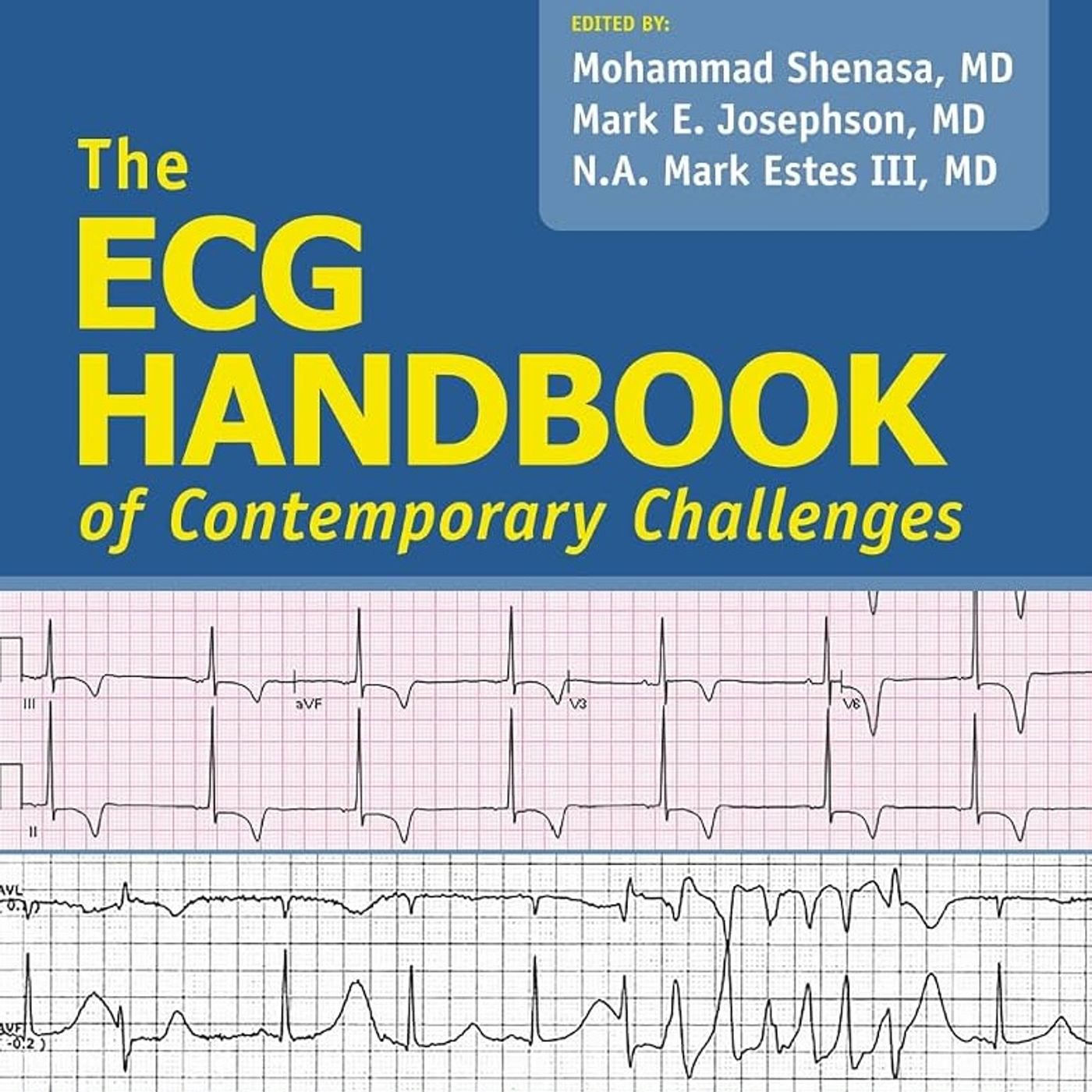 The ECG Handbook of Contemporary Challenges