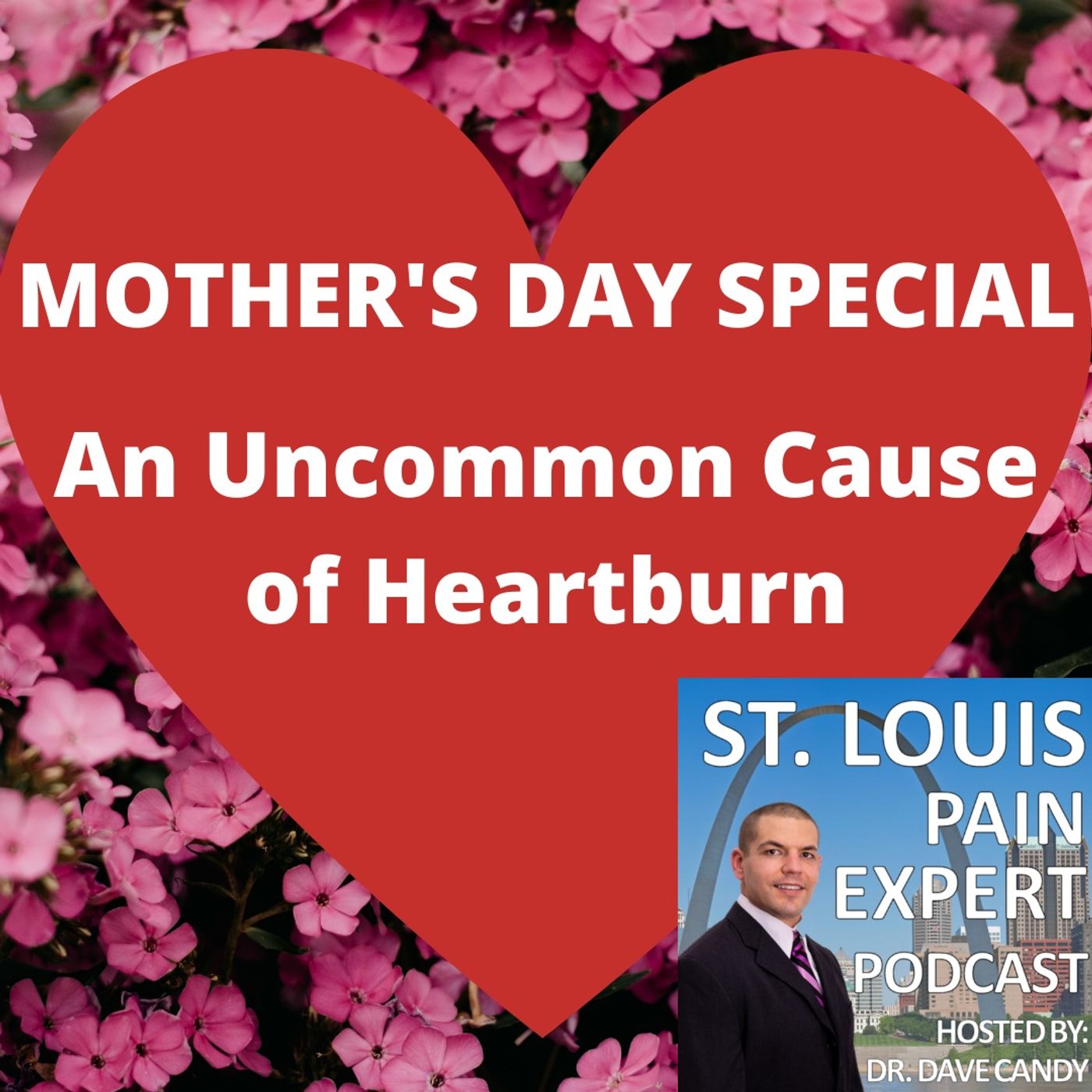 Mother's Day Special - An Uncommon Cause Of Heartburn
