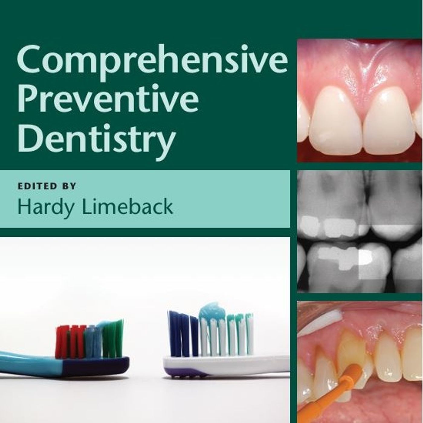 Comprehensive Preventive Dentistry