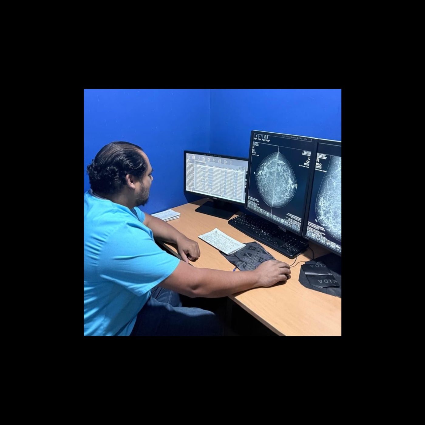 💗 IMSS TLAXCALA REFUERZA LA DETECCIÓN TEMPRANA DE CÁNCER DE MAMA Y CERVICOUTERINO 💗 💗 IMSS TLAXCALA REFUERZA LA DETECCIÓN TEMPRANA DE CÁNCER DE MAMA Y CERVICOUTERINO 💗