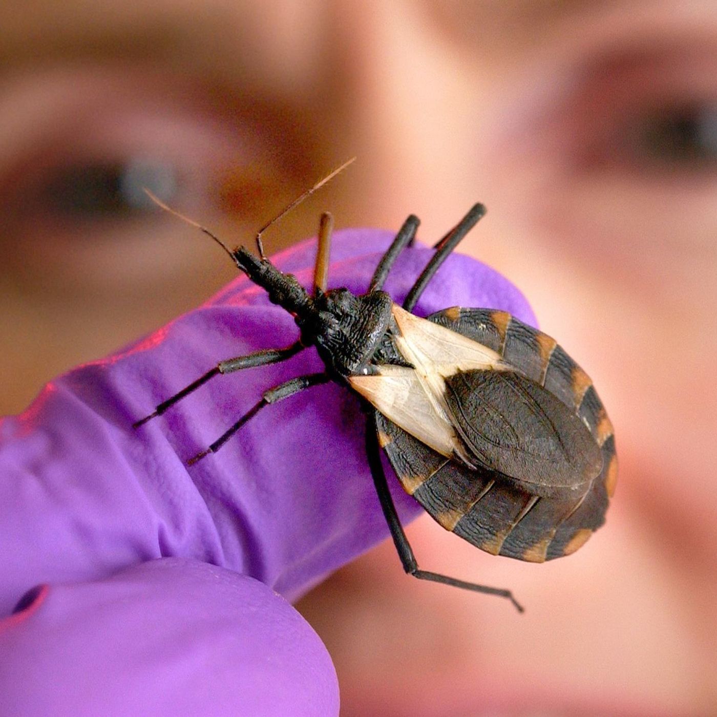 Dia Mundial de Combate à Doença de Chagas foca em estigmas sobre mulheres episode artwork