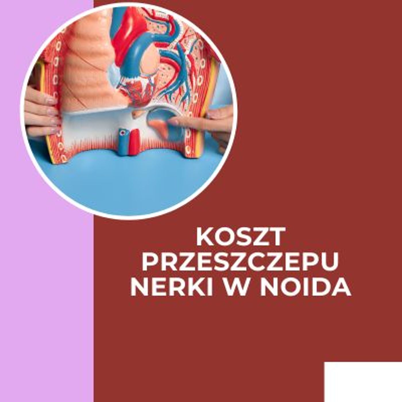 Jaki jest koszt przeszczepu nerki w Noid cover art