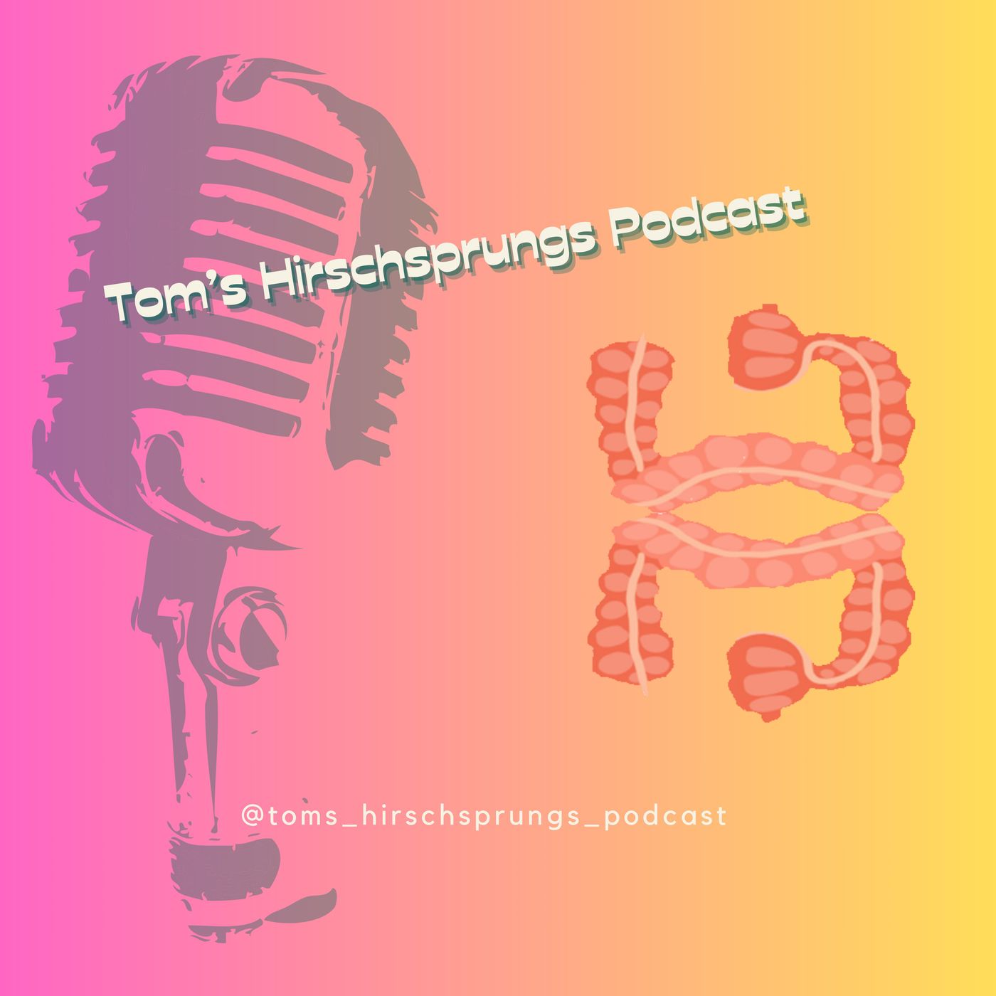 Tom\'s Hirschsprung\'s Podcast