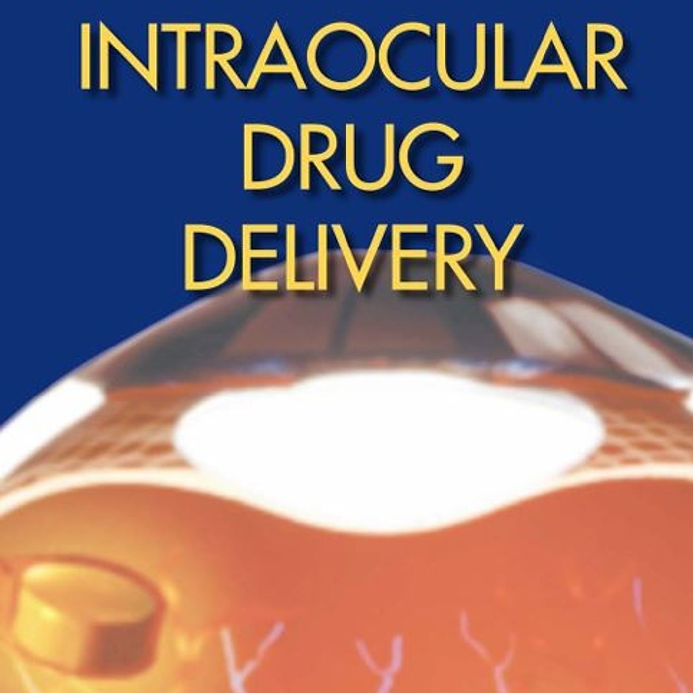 Intraocular Drug Delivery Intraocular Drug Delivery