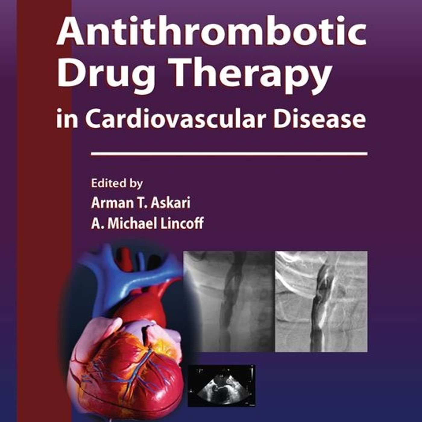 Antithrombotic Drug Therapy in cardiovascular Disease episode artwork