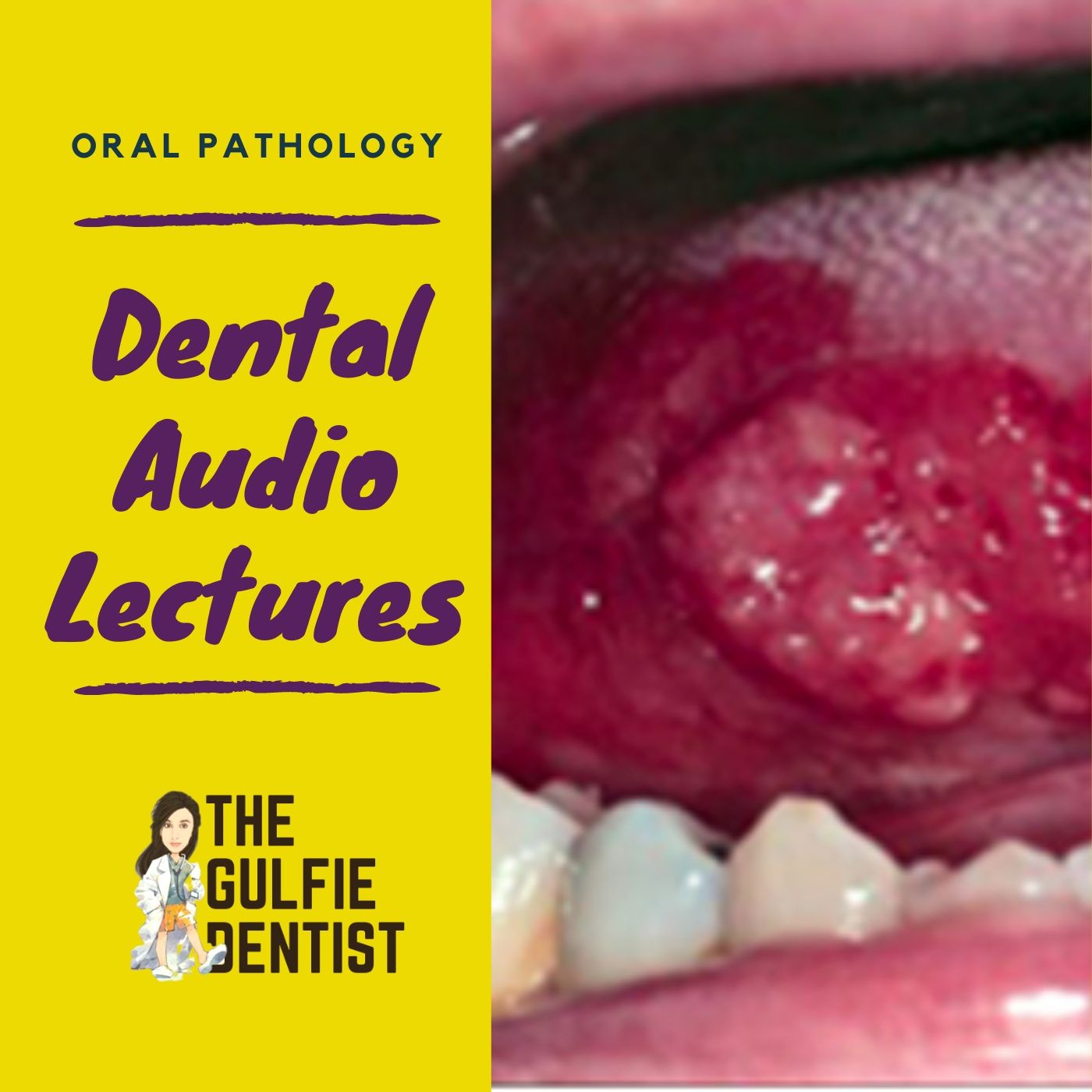 Oral Pathology